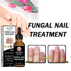 Cairan Perawatan Kuku 50ml Nail Care Untuk Jamur Kuku Perawatan Jamur Kuku Jamur Kuku Nail Art Perawatan Jamur Kuku Lembut Cairan Perbaikan Kulit Mati Pelembab Nutrisi Kuku