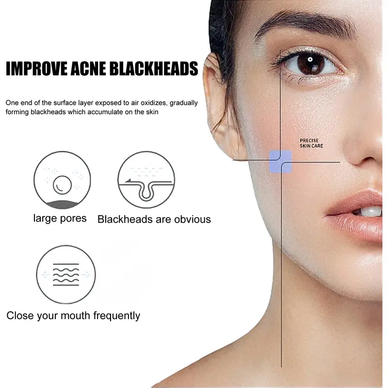 EELHOE Peel-off Nose Mask 30g Membersihkan Pori-Pori Dalam Dari Komedo Dan Perawatan Jerawat Hidung Treatment 2