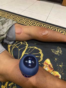 Product Review of Alat Bekam Elektrik Pintar / Alat Penghilang Cape Pegal from H**y S**o 0