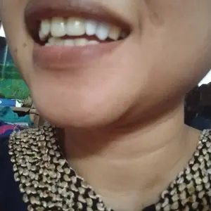 Etalase Promo isi 250 biji Khusus Gigi Sesuai Live dan Video