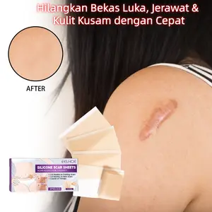 Silicone Scar Sheet  roll tape Plester silikon untuk keloid dan bekas luka size 4cmx1.5m 1 Roll Alat Ajaib Memperhalus & Meredakan Parut, Anti Air & Bernapas, Menempel Rapi pada Luka, Tanpa Jejak Setelah Dilepas, Kode Produk S2T5