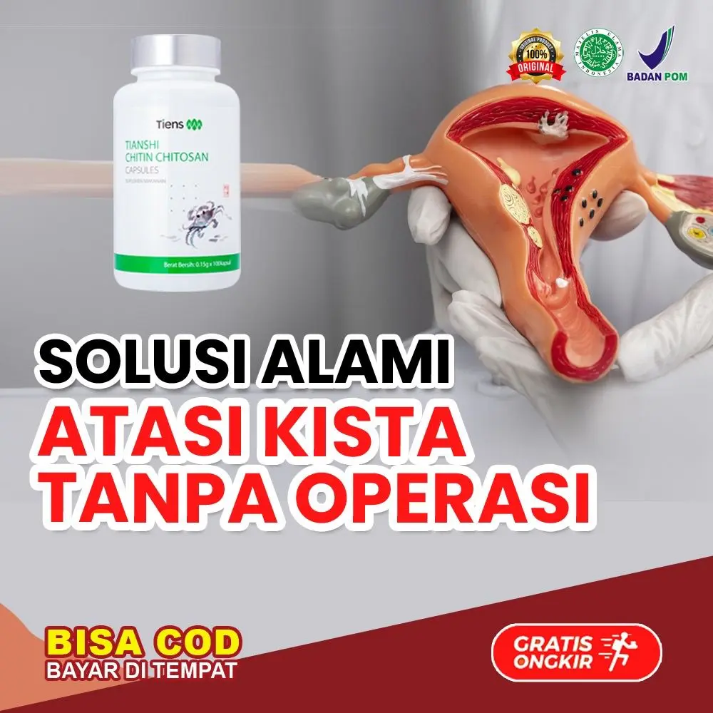 SUPLEMENT HERBAL CINA Serat Shitin/chitin Membantu Atasi Kista Ovarium dan Miom