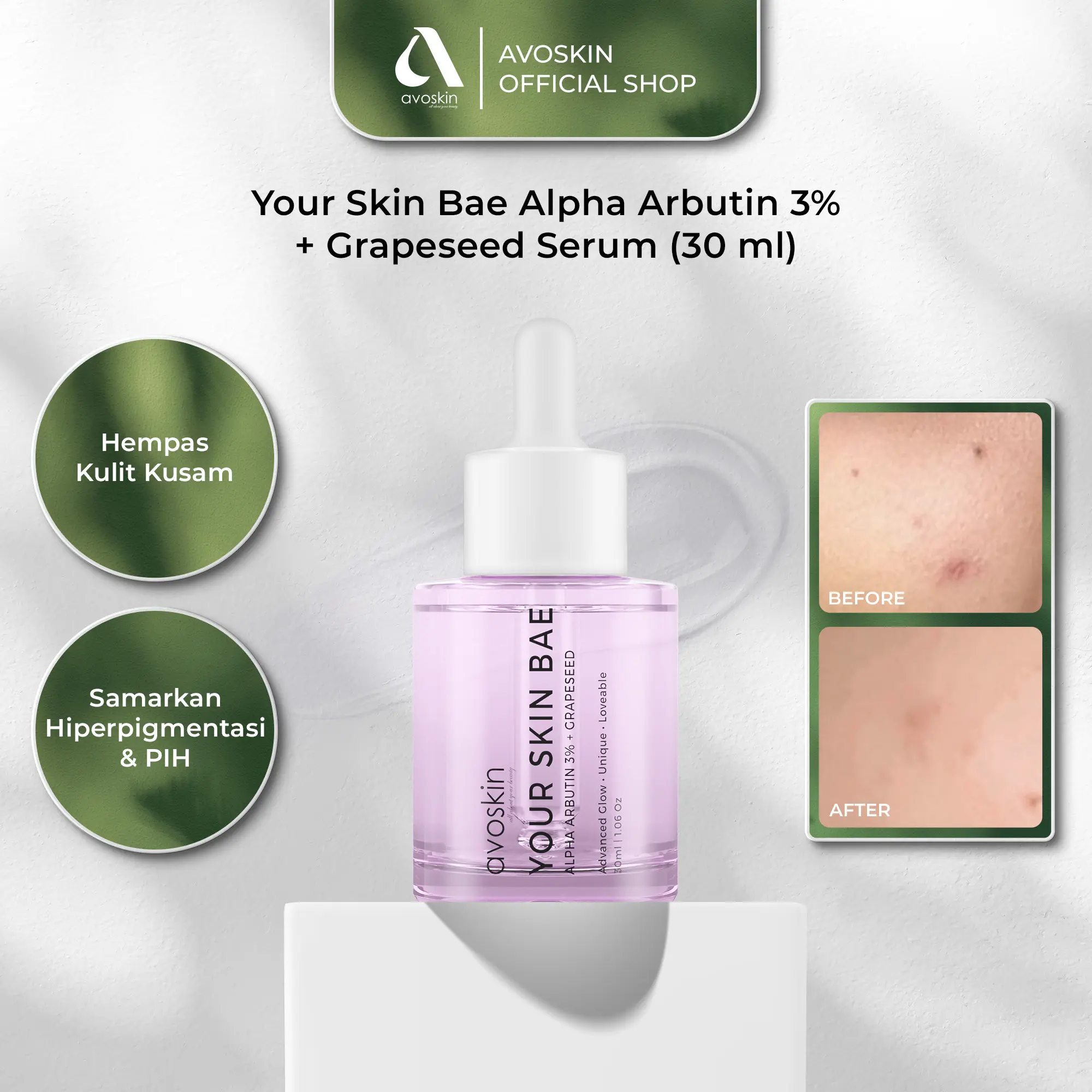 Serum Avoskin Your Skin Bae Alpha Arbutin 30ml -  Perawatan Samarkan Bekas Jerawat Wajah