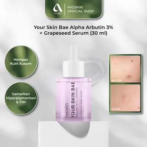 Serum Avoskin Your Skin Bae Alpha Arbutin 30ml -  Perawatan Samarkan Bekas Jerawat Wajah
