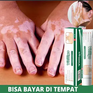 Obat Penghilang Vitiligo Salep Krim Vitiligo Bintik Putih Salep vitiligo Obat vitiligo untuk kulit bercak putih jerawat keringat  krim concealer noda melanin salep khusus vitiligo Salep obat luar untuk vitiligo