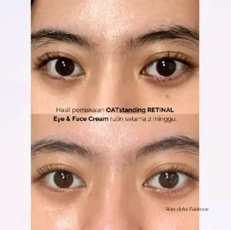 Finally Found You!! OATSTANDING RETINAL Eye & Face Cream skincare skin glow 3