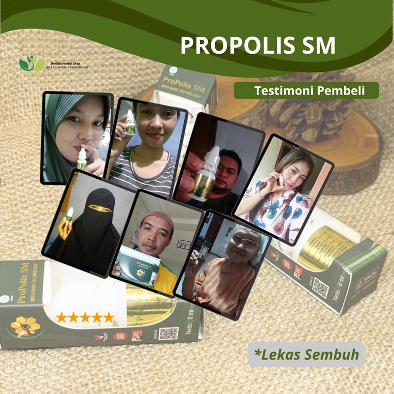 Propolis SM  Tetes Borok, Obat Luka Bernanah, Obat Gatal Menahun, Obat Gatal Berair, Gatal  Merah Eksim Bernanah Budug 2