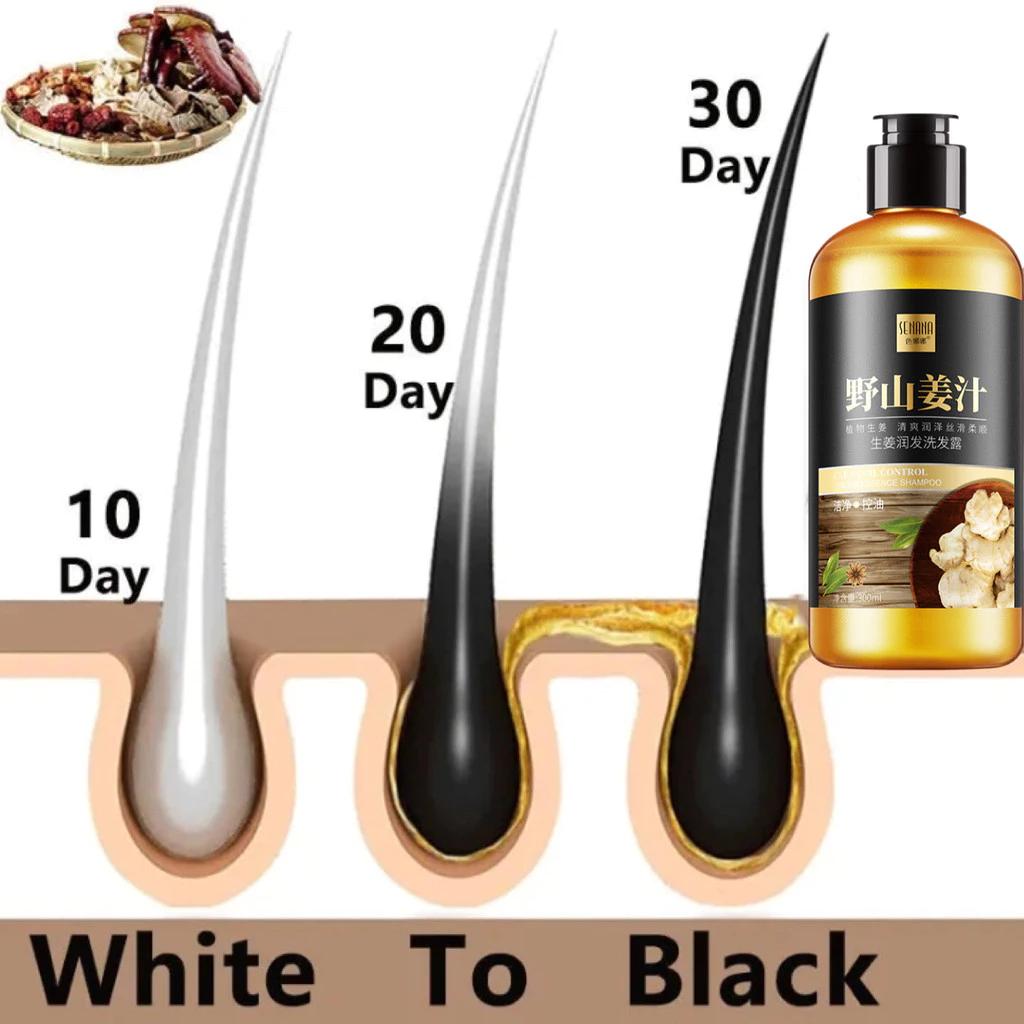 Shampo Penumbuh Rambut Cepat Ginger Shampoo 300ml Anti Rontok & Anti Ketombe Kontrol Minyak Nutrisi Rambut Perawatan Rambut Hair Care Shampo Penumbuh Rambut Cepat Ginger Shampoo 300ml Anti Rontok & Anti Ketombe Kontrol Minyak Nutrisi Rambut Perawatan Rambut Hair Care