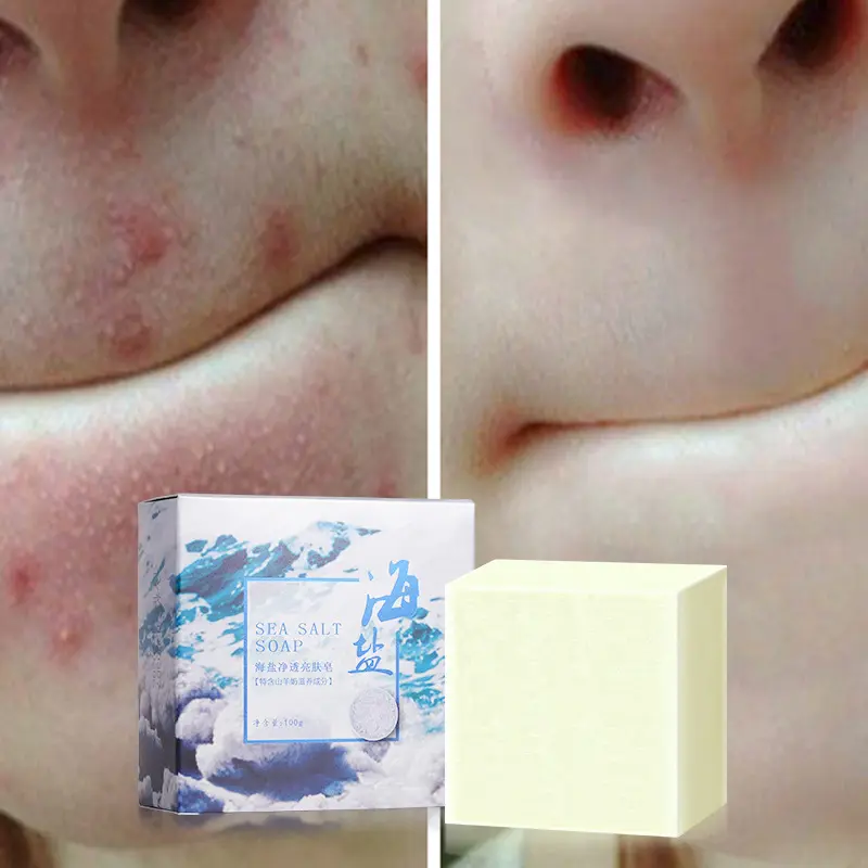 100g sea salt soap shrinks pores whitens and removes blackheads Addition to Mites 100% authentic  mite removal soap Acne & Oil Control Soap for Face & Body