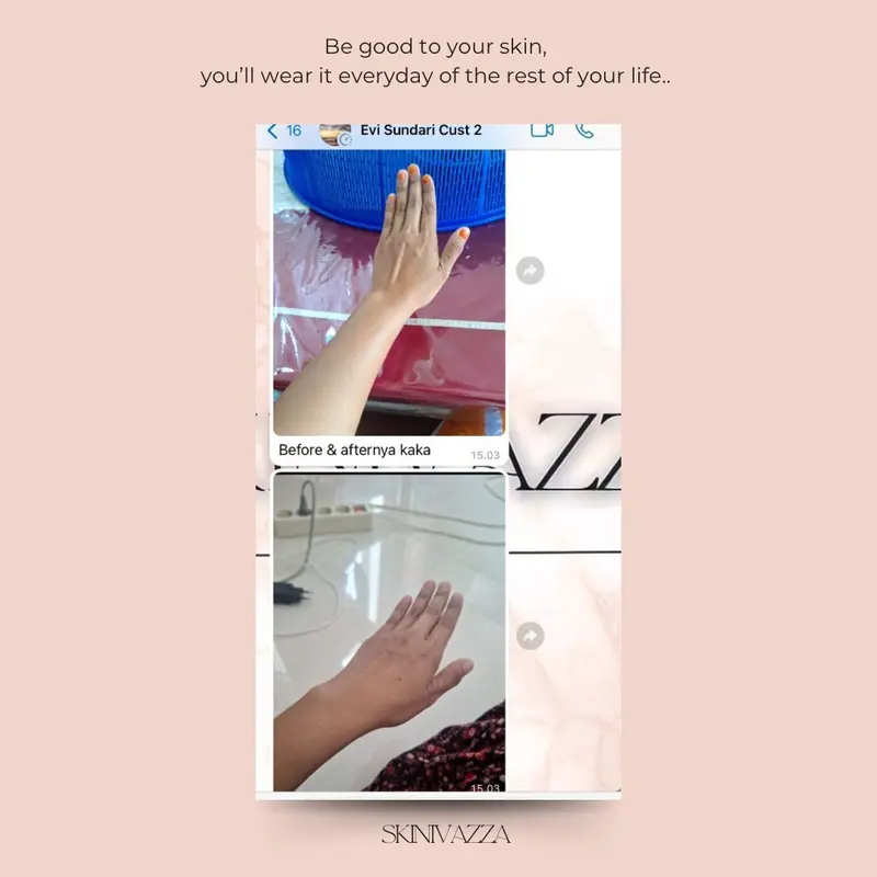 SKINIVAZZA - Salmon-DNA Extra Chromabright Whitening Lotion 8
