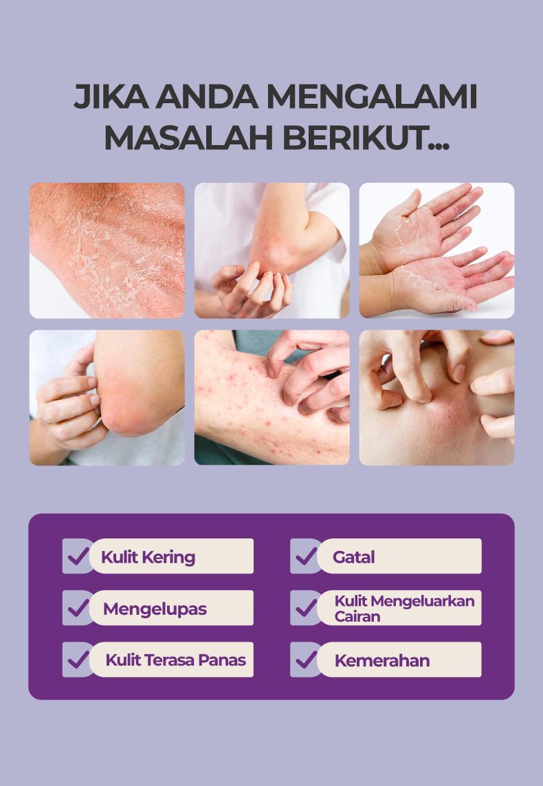 Kreain nature Skin Soothing Cream Meringankan eksim , kulit gatal, melembabkan dan melembabkan kulit