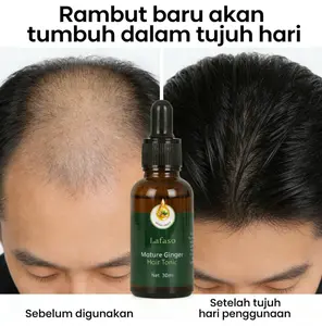 【Bisa COD】Rambut tebal hanya dalam satu minggu! Tanpa efek samping, ekstrak jahe alami, cocok untuk pria dan wanita, efektif mengatasi kerontokan rambut/kebotakan/penipisan rambut.