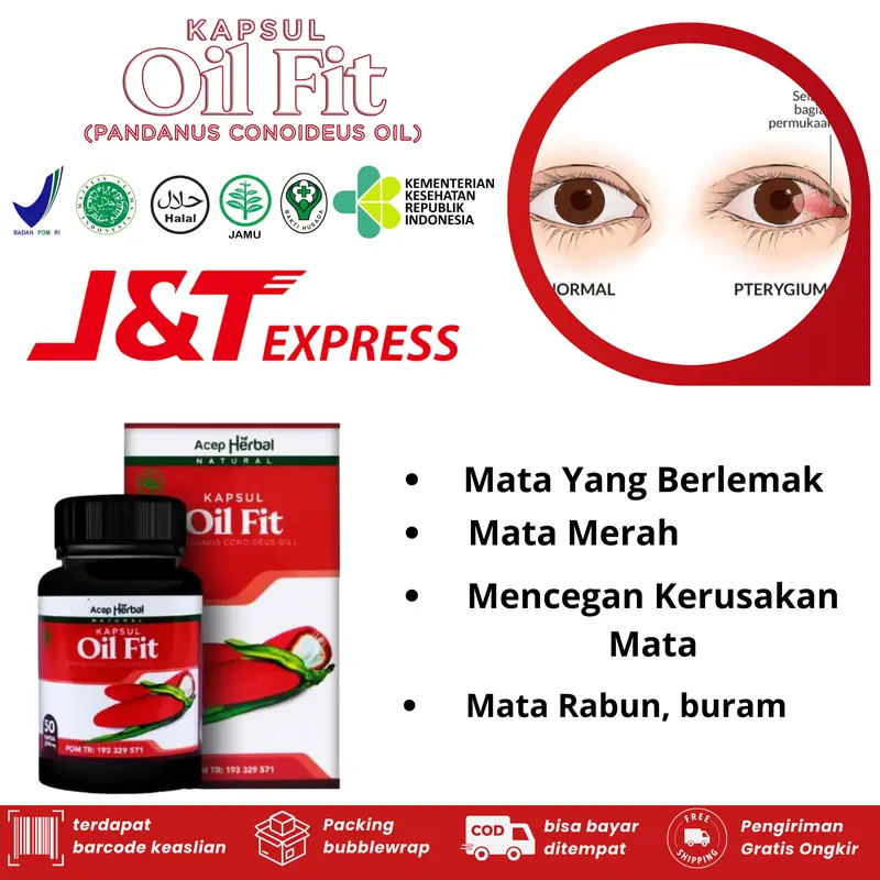 Oilfit Kapsul Herbal Mata Berlemak / Mata Kuning Penyakit Glukoma Pterygium 0