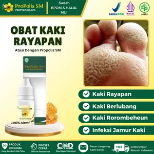 Propolis SM - Solusi Atasi Kaki Rayapan, Jamur di Kaki, Telapak Kaki Berlubang, Salep Oles Kaki Rayapan, Telepak Kaki Bau Atasi Dengan Propolis SM HALAL BPOM