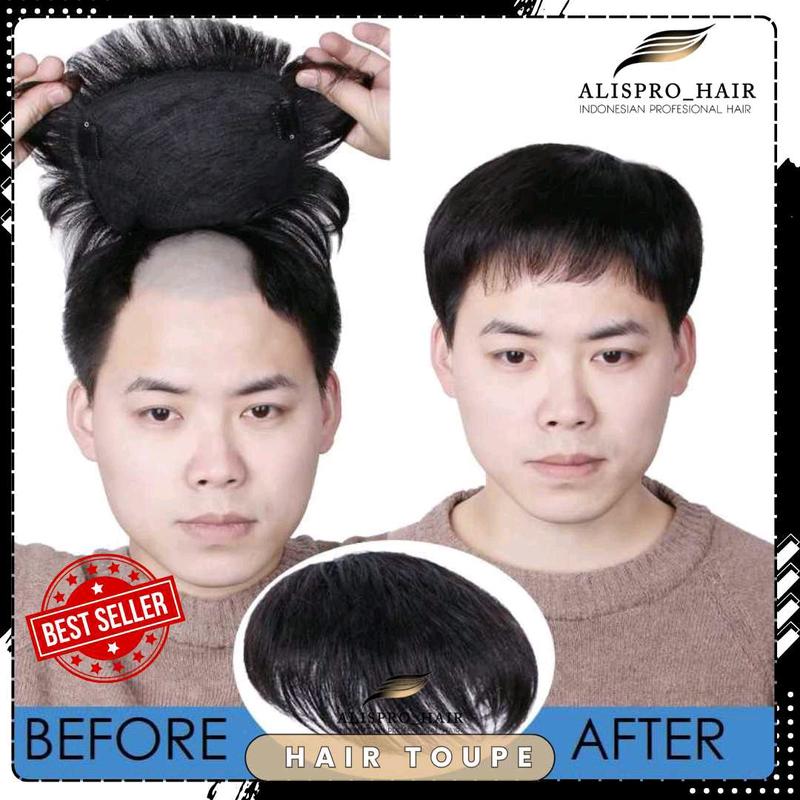 Alispro Hair Toupe Pria Rambut Penutup Botak Menggunakan 3 Klip - Shop ...