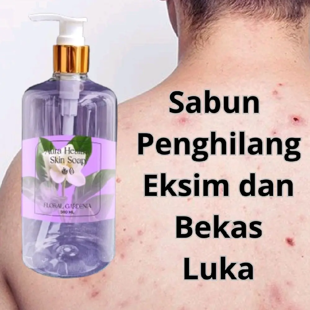 Sabun Mandi Cair Extract Vitamin E Wangi Floral mengatasi eksim dermatitis atopik menghilangkan Bekas luka Meredakan kulit kering  memberikan solusi efektif untuk membersihkan dan  Melembutkan serta  Mencerahkan perawatan kulit sehat terhidrasi