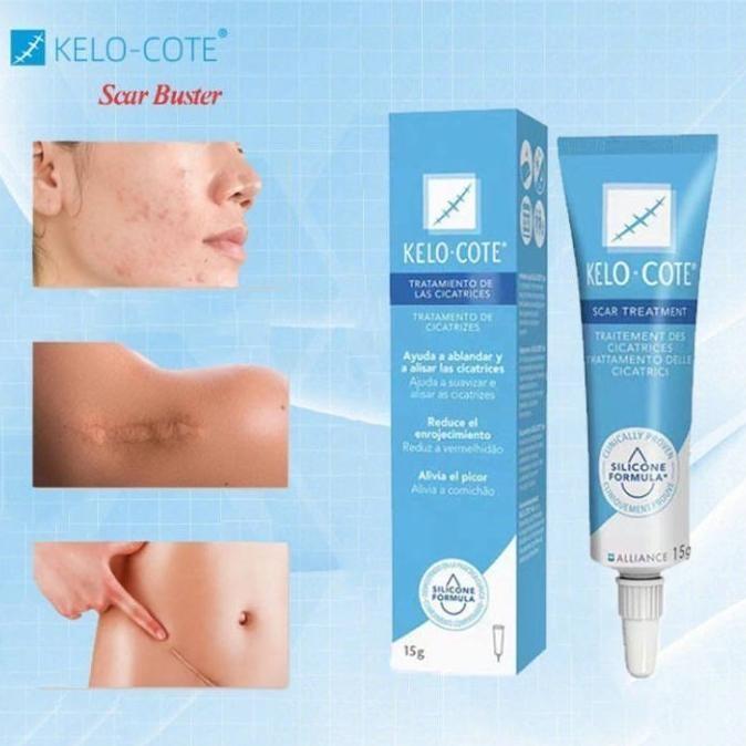 PACKING AMAN terbaru !!! skin_ kelo kote penghilang bekas luka / keloid / bekas 1