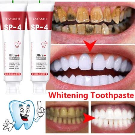 Pasta gigi pemutih gigi SP-4 120g Menghilangkan plak dan gigi berlubang Odol Pembersih Karang Gigi Perawatan Pemutihan Gigi Menghilangkan Bau Mulut Menghilangkan Noda Teh Penghilang karang gigi membandel Pasta gigi probiotik