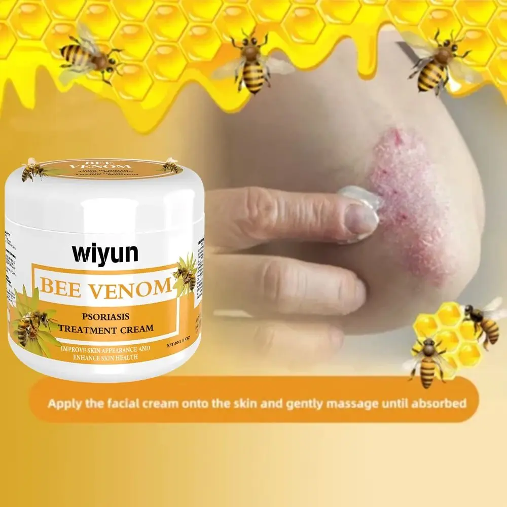 Effective Moisturizing Bee Venom Psoriasis Cream Red Itchy Smooth Bee Venom Cowhide Moss Cream Repair Hands and Feet Skin Moss Skin Care Bee Venom Cream Women Men