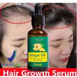 BPOM Penumbuh Rambut Cepat Serum Anti Botak Penipisan Rontok Cindynal Ginger Germinal Oil 30ML