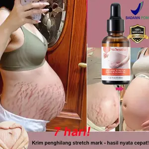 Stretch Mark Cream (Krim Penghilang Strechmark Aman untuk Ibu Hamil dan Menyusui)Krim Booster Elastisitas Kulit Penghilang Stretchmark Penghilang stretchmark solusi penghilang stretchmark perawatan stretchmark booster penghilang stretchmark