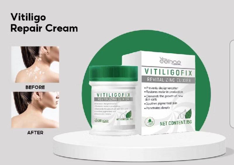 Product Introduction of krim penghilang vitiligo menghilanglan jamur panu dan mengatur pigmentasi kulit / vitiligo repair cream 17