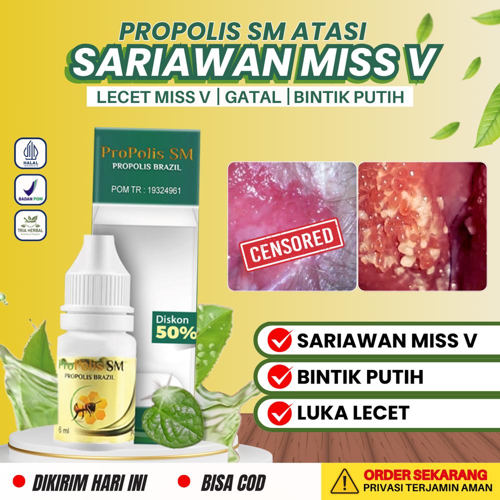 Cairan Tetes Perawatan Lecet Luka Sariawan Miss V, Atasi Kutil K3lam!n HPV Herpes, Keputihan Bau Becek Perih, Gatal Area Kewanitaan - Propolis SM Feminine