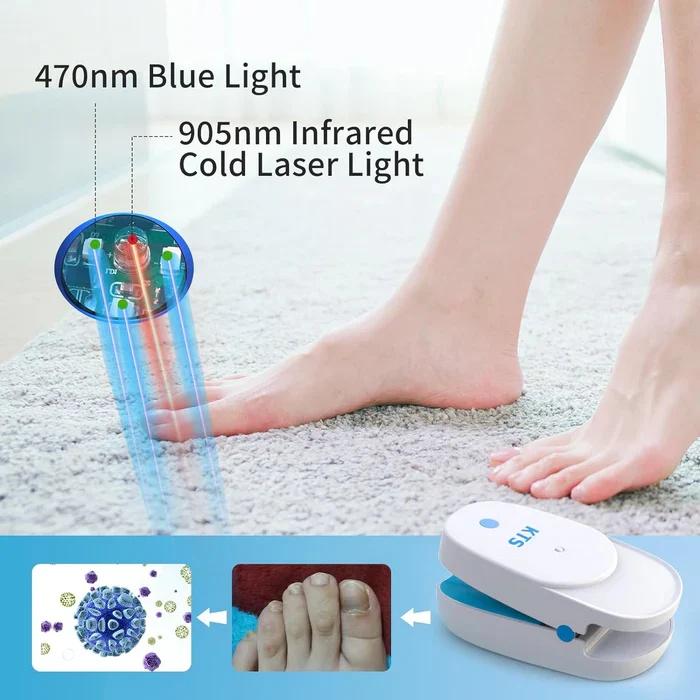 Nail Fungus Light Device For Toenail,Fingernail Fungus Treatment Extra Strength With 407nm Blue Light & 905nm light For Nail Fungus & Onychomycosis,Toe Nail Fungus Removal At Home 2