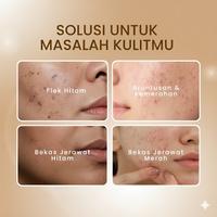 Gambar Leika Skincare Paket 3 in 1 Glowing Day Cream & Night Cream Facial Wash Toner BPOM Krim Penghilang Flek Hitam Mencerahkan Anti Aging Pelembab Muka - Paket 4 in 1 dari Pure Life Beauty Kota Cirebon 3 Tokopedia