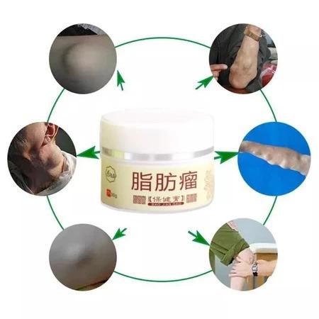 Lipoma Removal Cream Penghilang Kista & Lipoma Atasi Benjolan Lipoma Cepat Kempes Hilangkan Kista Lemak Kempes Tanpa Bedah
