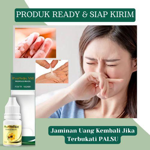 Propolis SM Untuk Keputihan Bau Tak Sedap, Keputihan Yang Gatal, Gatal Miss V, Obat Keputihan Lengket, Bau, Berwarna Hijau, Coklat, Keputihan Abnormal, Keputihan Bau Busuk, Mau Amis, Infeksi Bakteri, 
