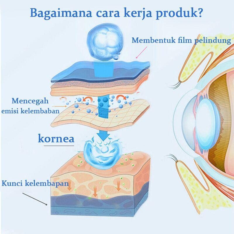 Eye Drops for Cataracts, Dry Eyes, Eye Pain, Red Bloodshot Eyes, Eye Strain 5