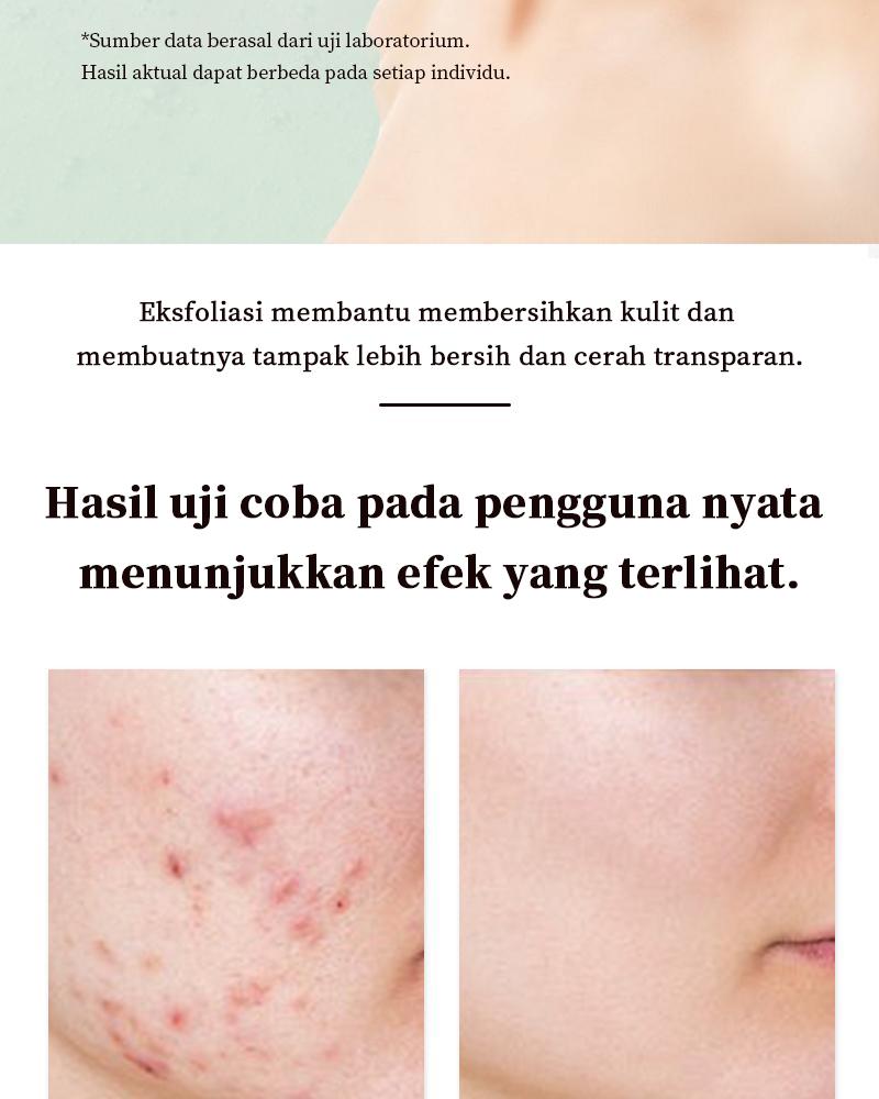 【Pengiriman Privasi】Meet Face Gel Pengelupasan Ekstrak Herba 50g Melembapkan & Menyuburkan Kulit Kusam Cocok untuk Wanita Berminyak Perawatan Wajah Harian
