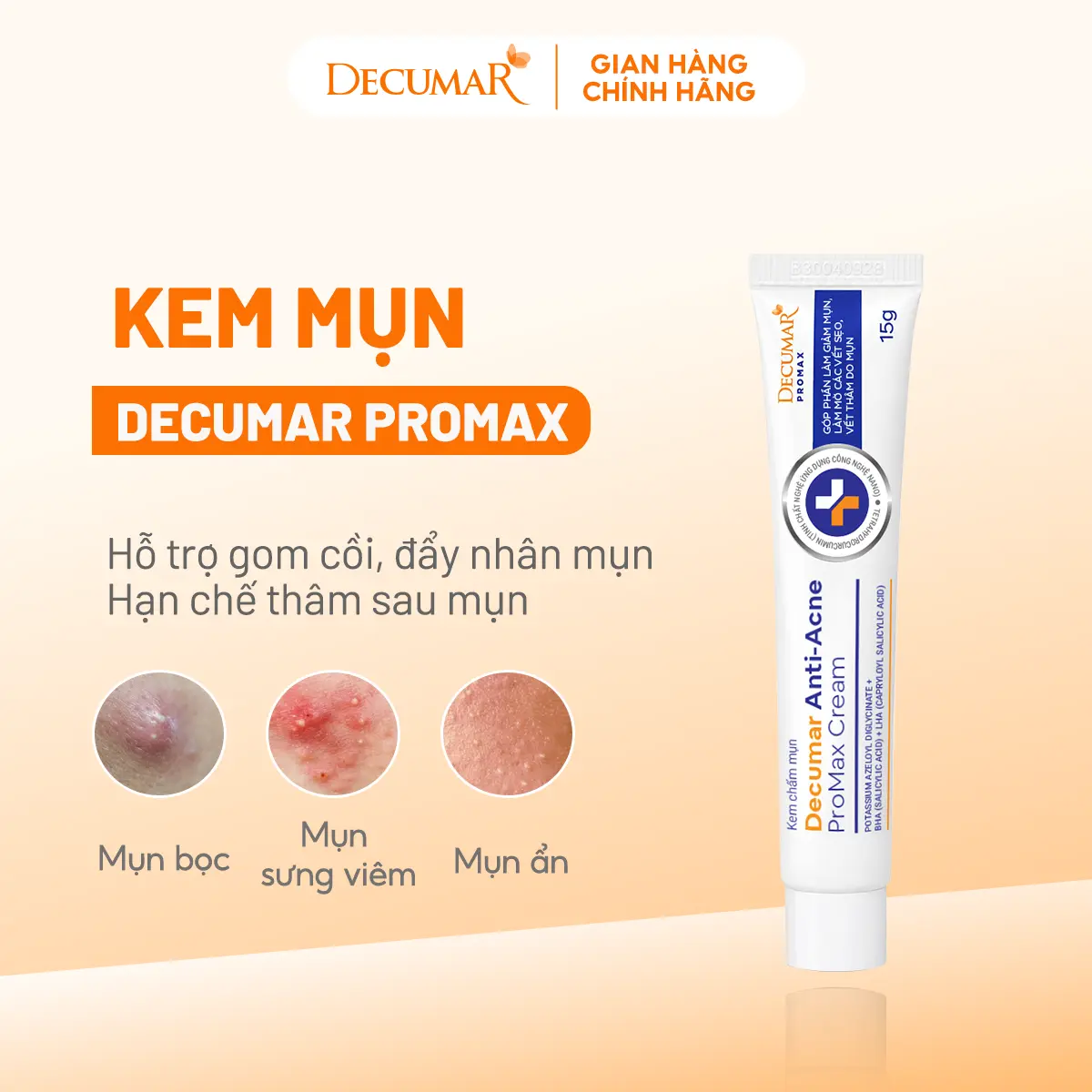 Decumar Kem mụn hỗ trợ giảm mụn, ngăn ngừa thâm mụn, ngăn ngừa mụn mới Decumar ProMax 15g – Hỗ trợ giảm mụn bọc, mụn sưng viêm, mụn ẩn, mụn trứng cá, mụn liti, mụn đầu đen – DPM01