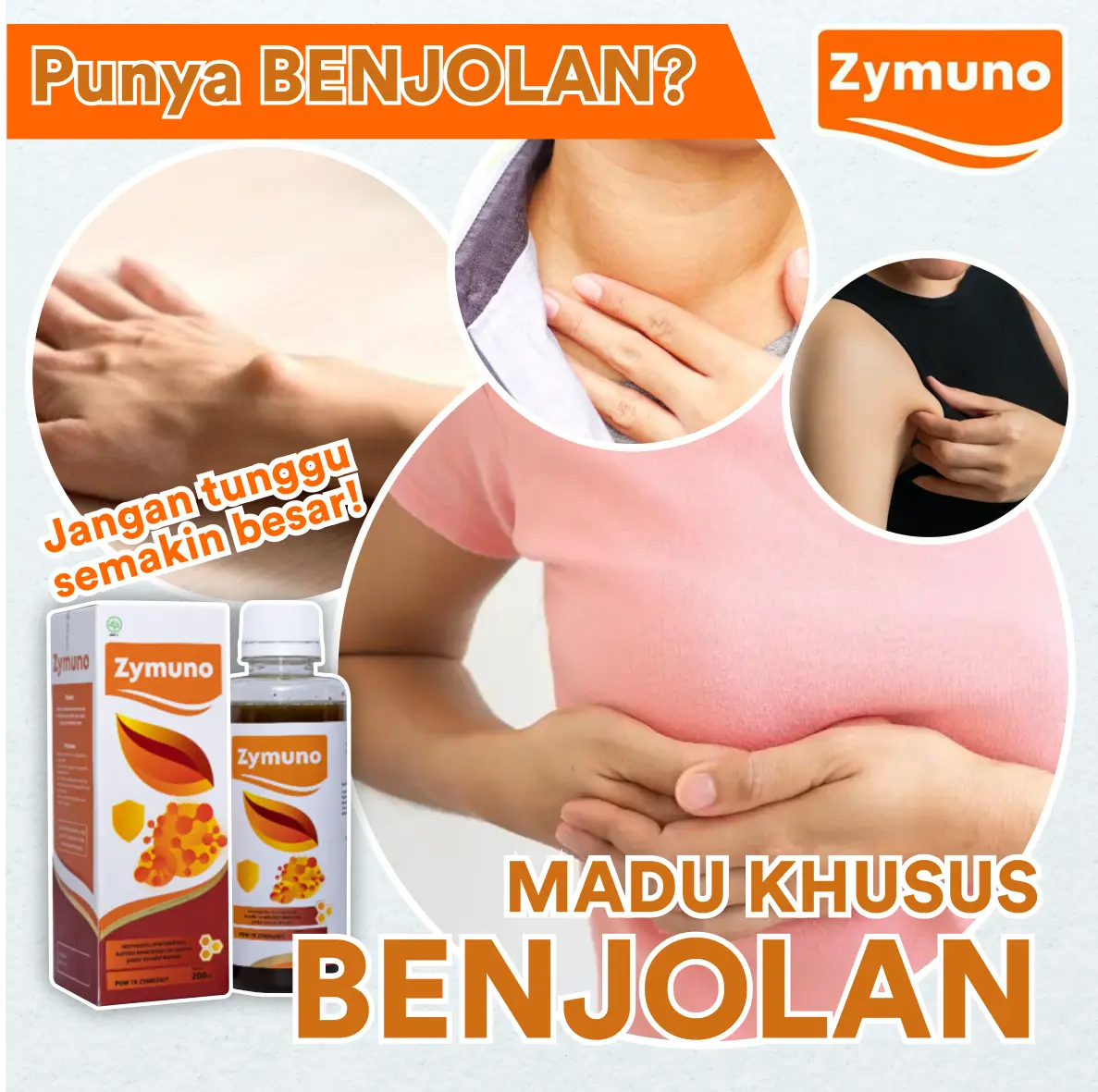Madu Zymuno Khusus Mengempiskan BENJOLAN di PD, Ketiak, Tangan & Leher 1 Botol @200ml Original - [Halal dan BPOM, murah]