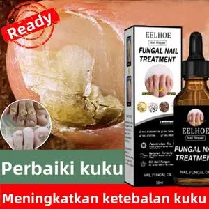 Obat Jamur Kuku Perawatan Jamur Kuku Paronychia Perawatan Lumut Kuku obat kuku jamur dan rusak Nail Care Anti Jamur Perawatan Kuku obat Kuku Berjamur Penghilang Jamur Kuku Gel Anti Infeksi Obat Kuku Bengkak Obat Kuku Kaki
