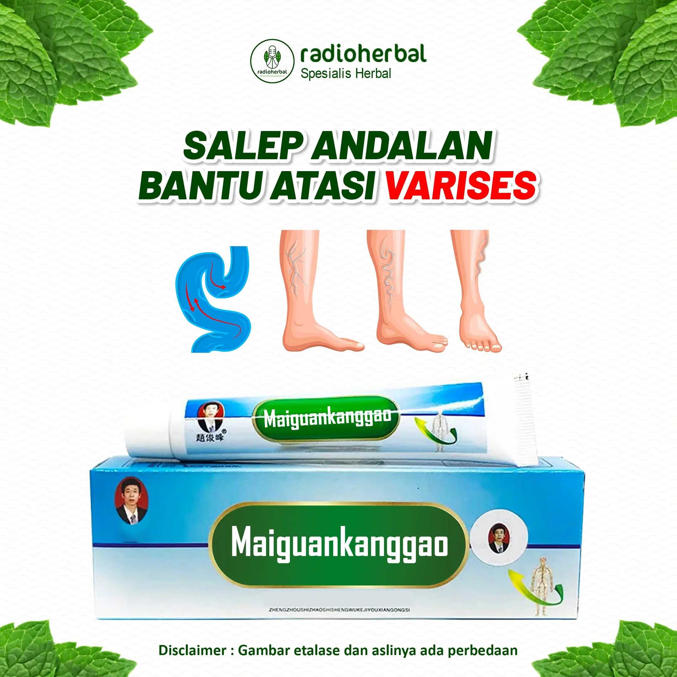 Salep Maiguankanggao Bantu Atasi Masalah Varises