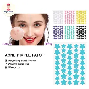 Acne Patch Bintang Warna Warni Lucu Stiker Jerawat Obat Pengempis Jerawat Ampuh  Manfaat acne patch untuk  1. Menutup dan melindungi jerawat dari debu dan kotoran lainnya  2. Men"cabut" jerawat matang  Tidak semua jenis jerawat bisa diatasi / tercabut den