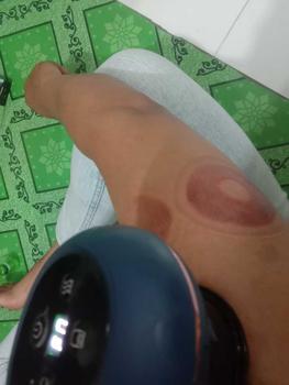 Product Review of Alat Bekam Elektrik Pintar / Alat Penghilang Cape Pegal from f**3 1