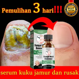 badge Obat Jamur Kuku Serum Kuku Obat Kuku Rusak Dan Jamur Vitamin Kuku Kering Dan Rusak Perawatan Kuku Obat Cantengan Nail Fungus Treatment