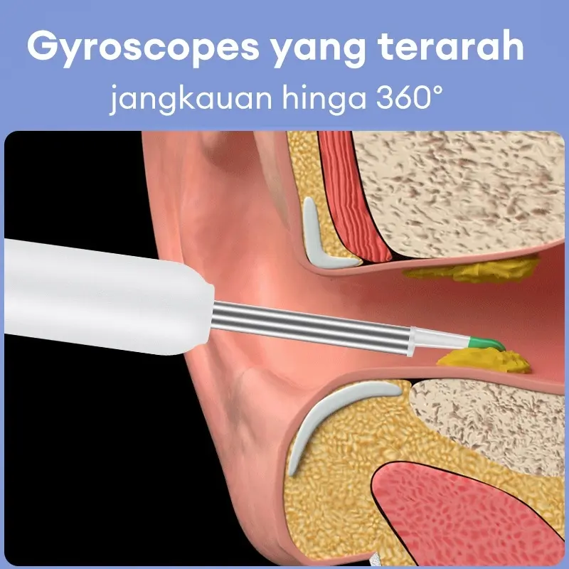 【Garansi 10 tahun】Korek kuping led Pembersih Telinga bayi alat pembersih telinga WIFI ear wax 5 in 1 Stainless steel besi earwax Senter  Dapat dihubungkan ke ponsel 2