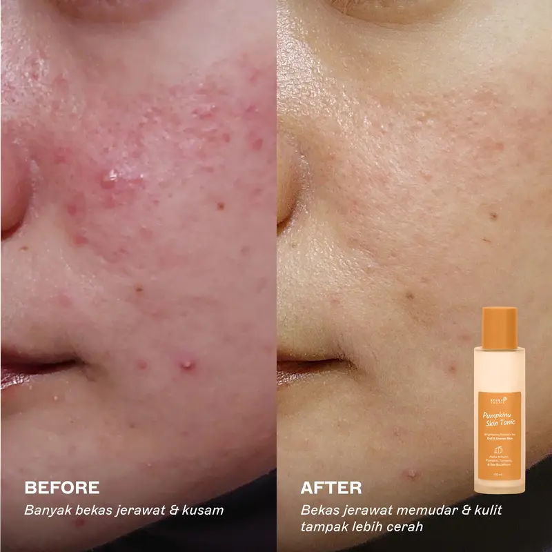 STUDIO TROPIK Pumpkinu Skin Tonic - Toner untuk mencerahkan/brightening kulit kusam | Flek hitam dan bekas jerawat pudar | Mengandung Alpha Arbutin, Pumpkin Extract dan Sea Buckthorn 2