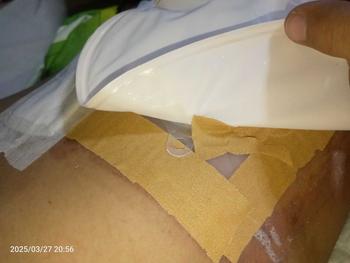 Product Review of Partners Colostomy Bag 57mm (Set) Organiser Plastic Organiser Plastic from p**a 2