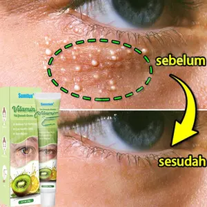 Cream Milia Penghilang Milia Paling Ampuh krim penghilang milia syringoma xanthelasma butiran lemak sekitar mata Cream Milia Ampuh Penghilang Milia Penghilang Milia Di Bawah Mata