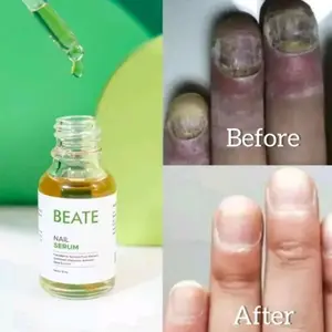 Beate Nail Serum Penghilang Sakit Kuku Rusak Cantengan Bernanah Kutikula Nail Art Perawatan Penumbuh Kuku COD