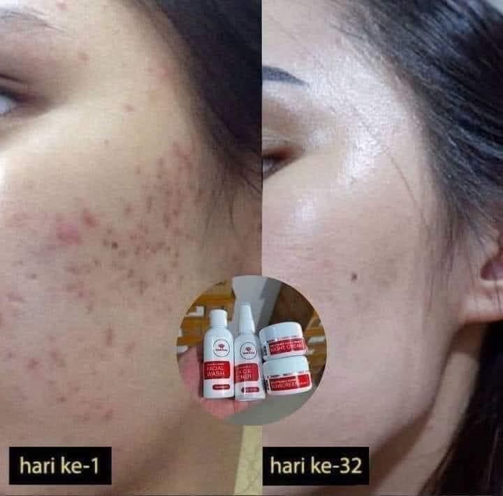 Maxie Skincare BPOM Agen Resmi ORIGINAL (free GIFT)