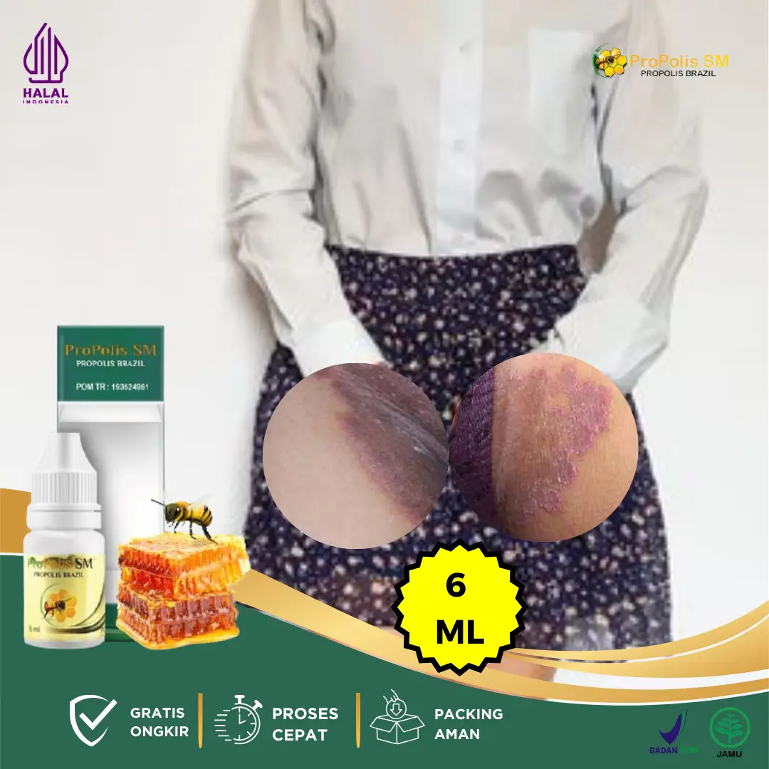 Gatal Selangkangan Pria Dan Wanita, Penghilang Selangkangan Hitam, Selangkangan Eksim Dan Jamur, Pembersih Jamur Diselangkangan, Tetes Pemutih Selangkangan Hitam