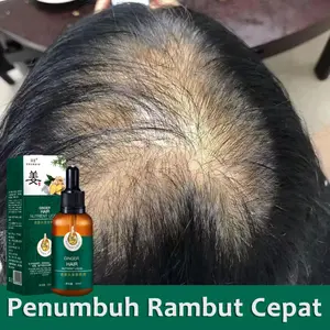 Serum Anti Botak Rambut Hair Oil Rambut Rontok Penumbuh Rambut Penebal Rambut Serum Penumbuh Rambut Botak