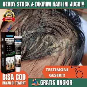 Sumifun obat gatal kepala ketombe Obat Psoriasis Parah Gatal Kulit Kepala 20g Obat Koreng Di Kepala Borok di Kulit Kepala Psoriasis Kulit Bersisik Kering Luka Borok Koreng Di Kepala Obat