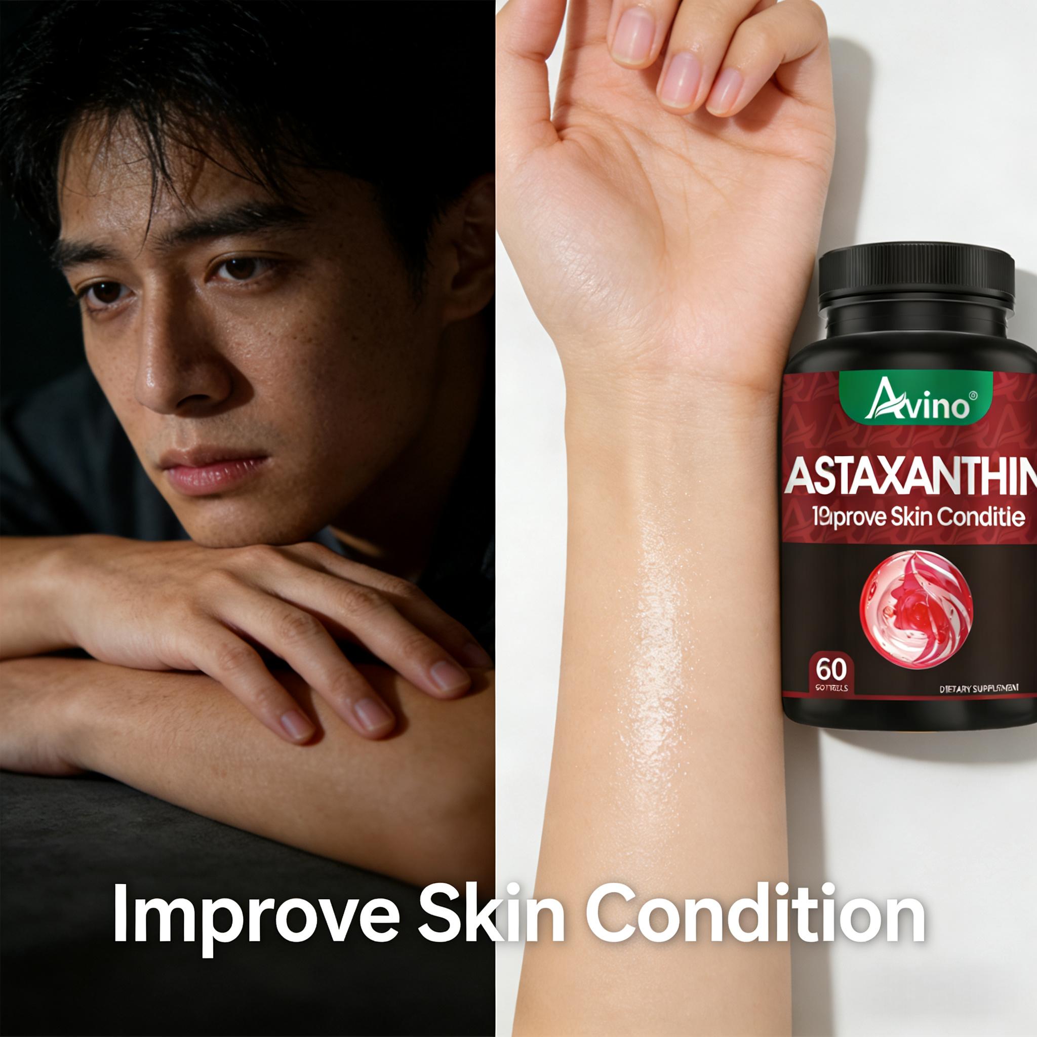 [Produk Baru] Avino Astaxanthin membantu menjaga kesehatan kardiovaskular dan kulit, memberikan manfaat antioksidan, melindungi mata dan sistem kardiovaskular, memperlambat penuaan, dan memiliki efek memutihkan | 60 kapsul